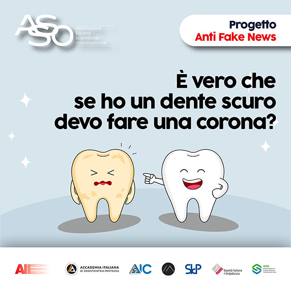 post_fake_2025_E’-vero-che-se-ho-un-dente-scuro-devo-fare-una-corona