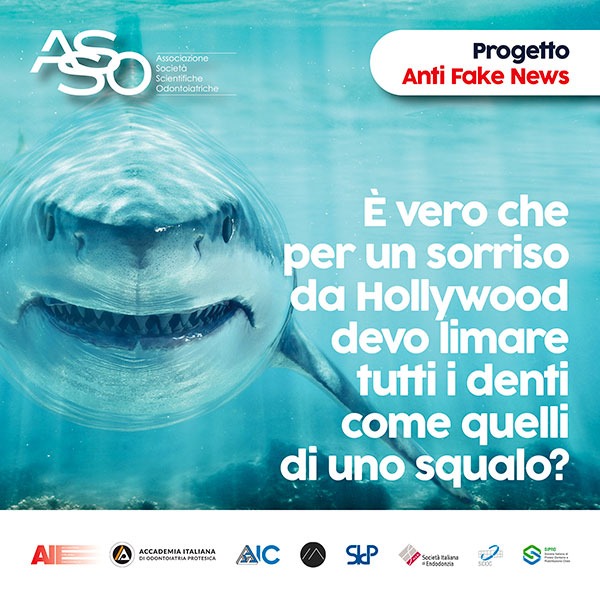 E’ vero che per un sorriso da Hollywood devo limare tutti i denti come quelli di uno squalo?post_E’ vero che per un sorriso da Hollywood devo limare tutti i denti come quelli di uno squalo?